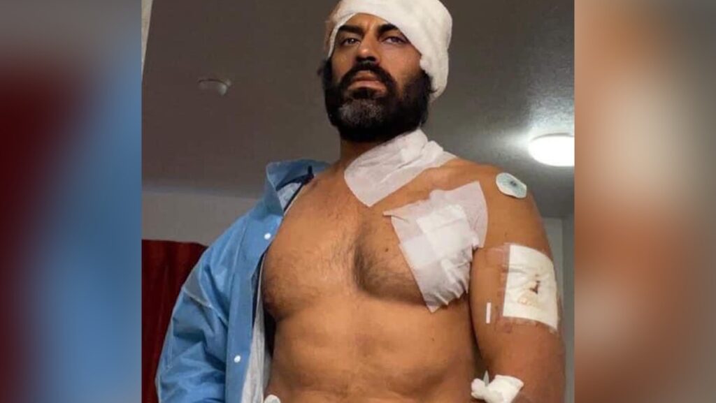 Indiase acteur Aman Dhaliwal aangevallen op sportschool in VS